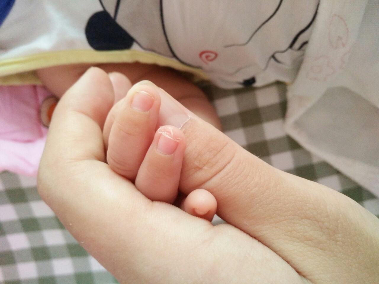 孩子指甲有白斑、凹陷 應(yīng)該補(bǔ)哪些微量元素